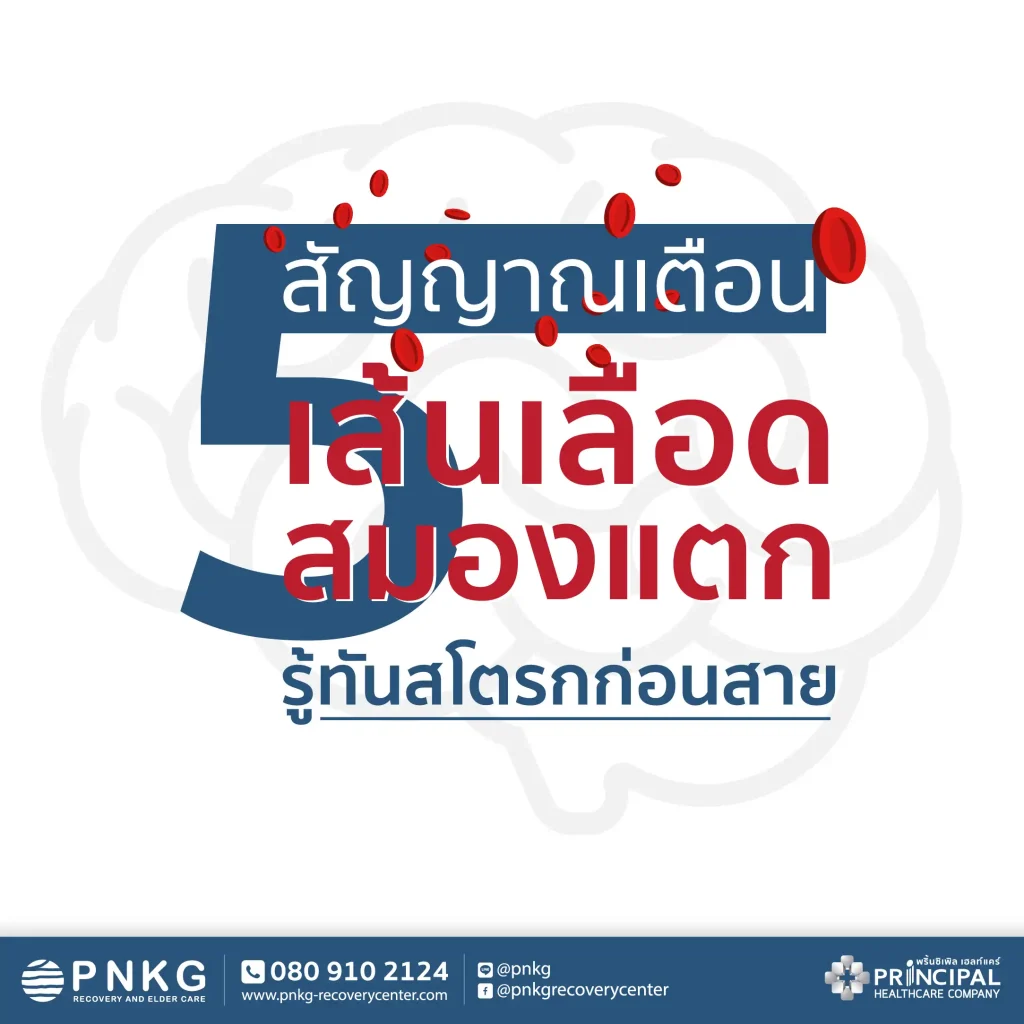 5 สัญญาณเตือน เส้นเลือดสมองแตก รู้ทันสโตรกก่อนสาย