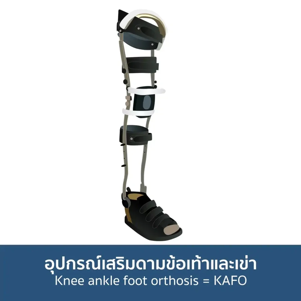 สโตรก (Stroke) ฟื้นฟูอย่างไรให้กลับมาใกล้เคียงปกติมากที่สุด