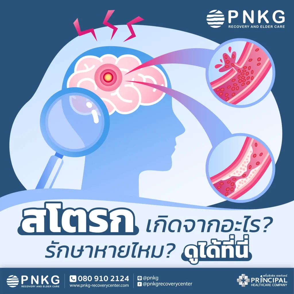 สโตรก เกิดจากอะไร? รักษาหายไหม? ดูแลอย่างไร ดูได้ที่นี่